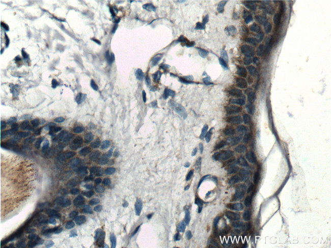 SLC17A9 Antibody in Immunohistochemistry (Paraffin) (IHC (P))