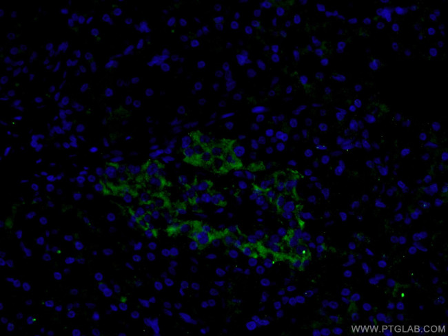 SLC17A9 Antibody in Immunohistochemistry (PFA fixed) (IHC (PFA))