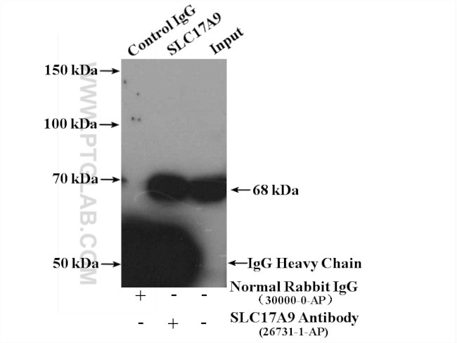 SLC17A9 Antibody in Immunoprecipitation (IP)