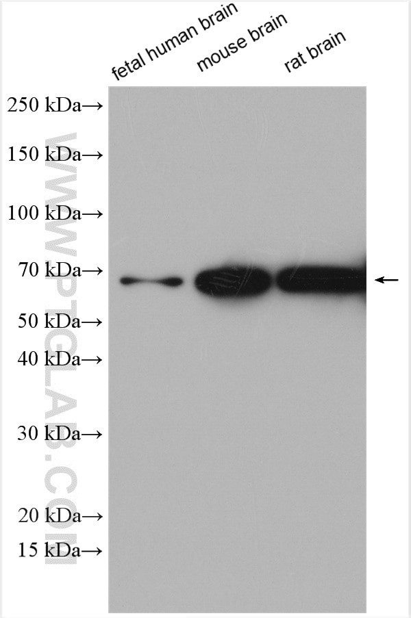 SLC17A9 Antibody in Western Blot (WB)