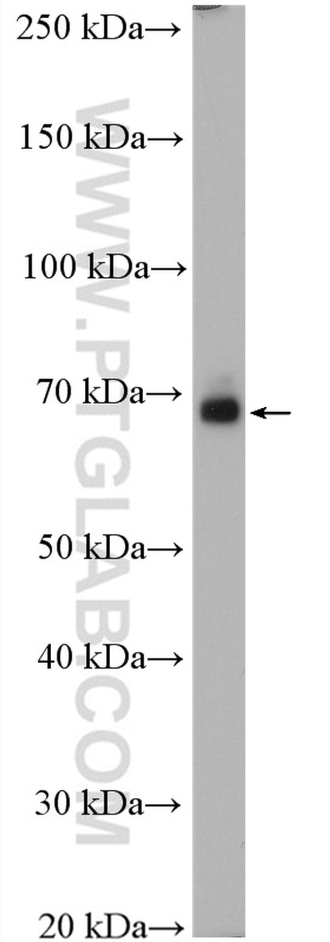 SLC17A9 Antibody in Western Blot (WB)