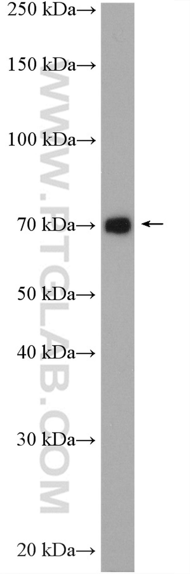 SLC17A9 Antibody in Western Blot (WB)