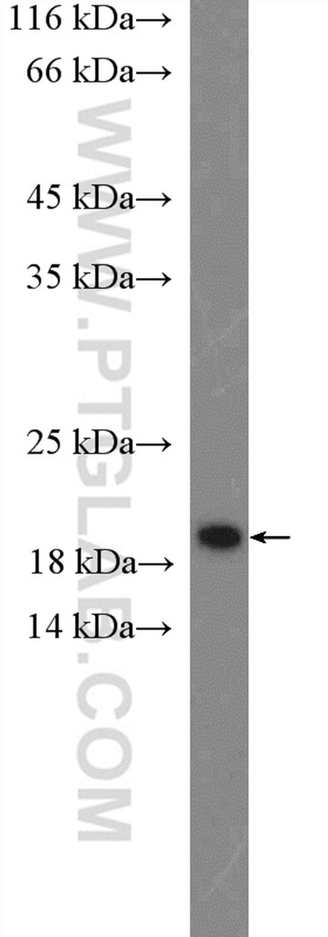 CENPA Antibody in Western Blot (WB)