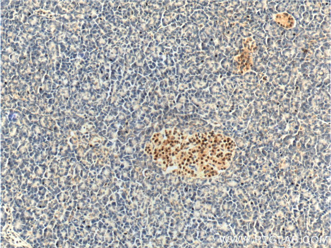 Cyclin D3 Antibody in Immunohistochemistry (Paraffin) (IHC (P))