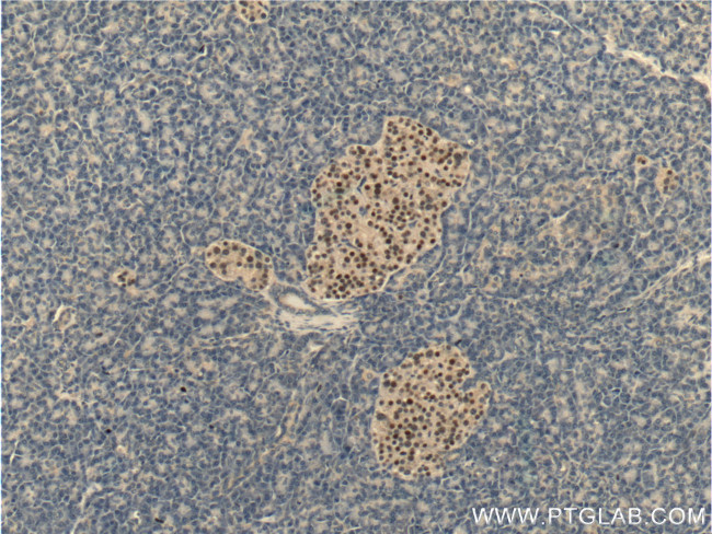 Cyclin D3 Antibody in Immunohistochemistry (Paraffin) (IHC (P))