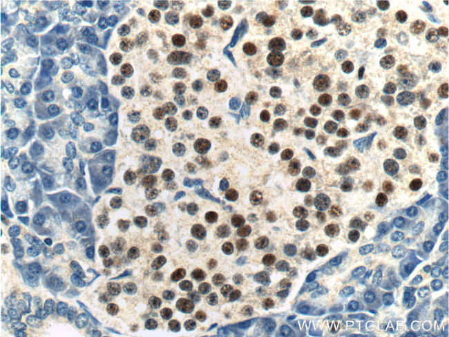 Cyclin D3 Antibody in Immunohistochemistry (Paraffin) (IHC (P))