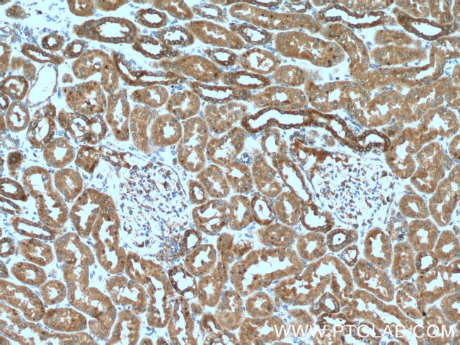 CXCR3 Antibody in Immunohistochemistry (Paraffin) (IHC (P))