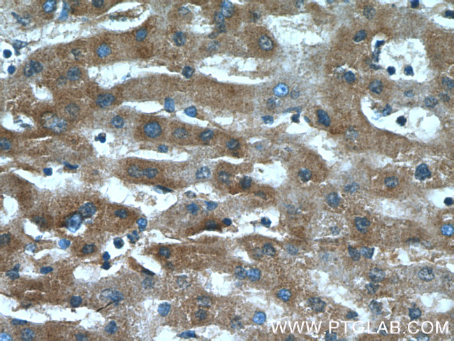 CXCR3 Antibody in Immunohistochemistry (Paraffin) (IHC (P))