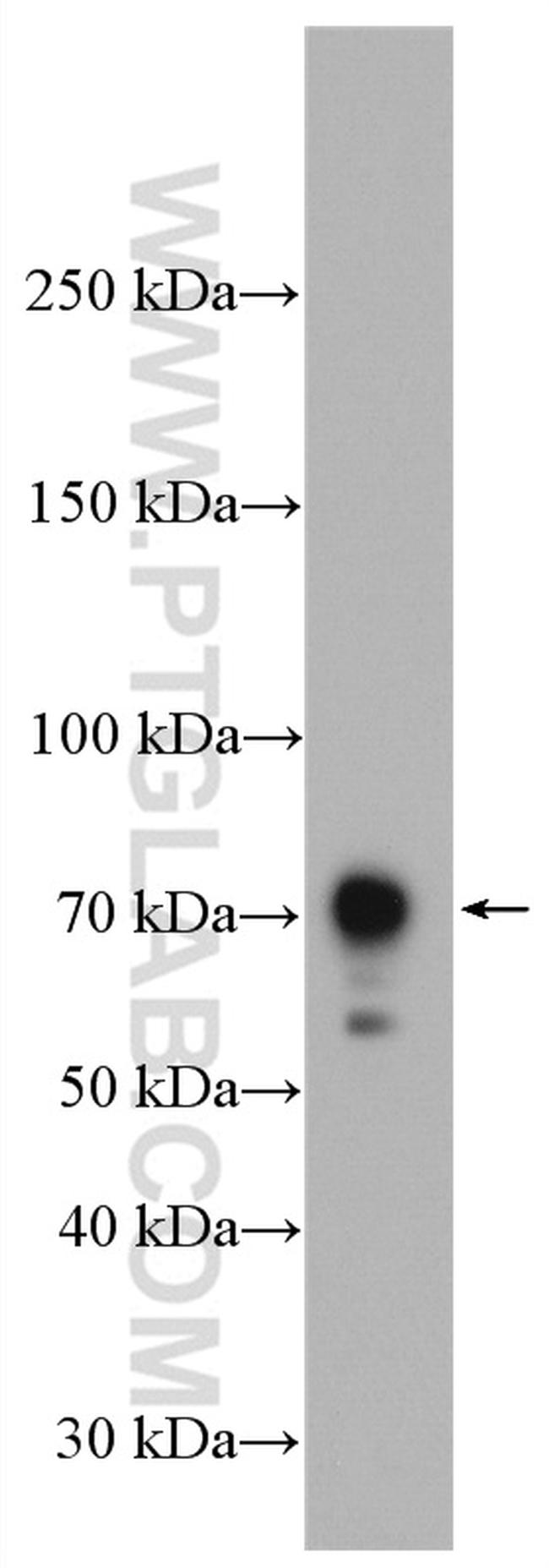 CXCR3 Antibody in Western Blot (WB)