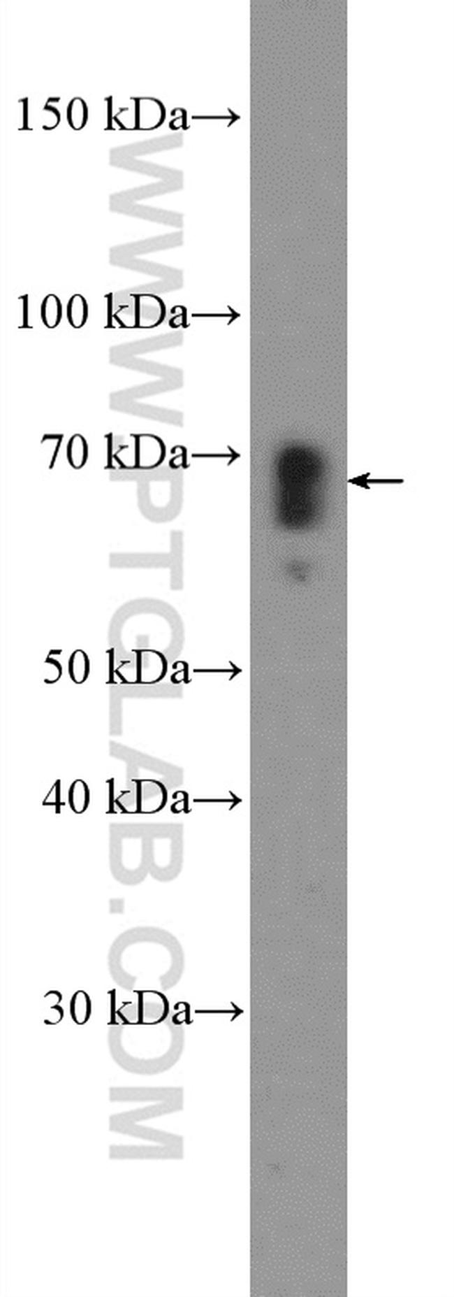 CXCR3 Antibody in Western Blot (WB)