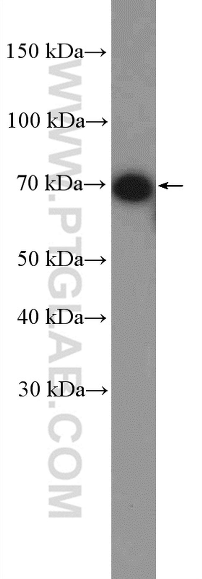 CXCR3 Antibody in Western Blot (WB)