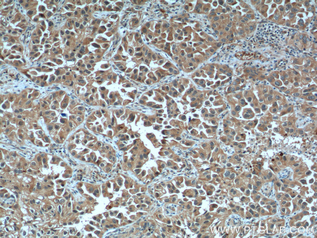 LIF Antibody in Immunohistochemistry (Paraffin) (IHC (P))