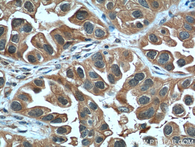 LIF Antibody in Immunohistochemistry (Paraffin) (IHC (P))