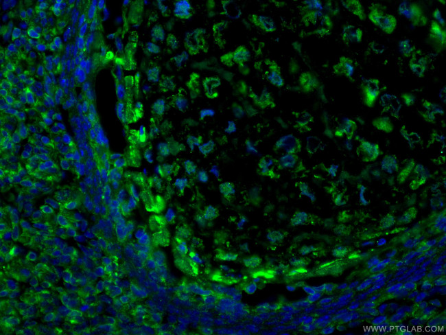 LIF Antibody in Immunohistochemistry (PFA fixed) (IHC (PFA))