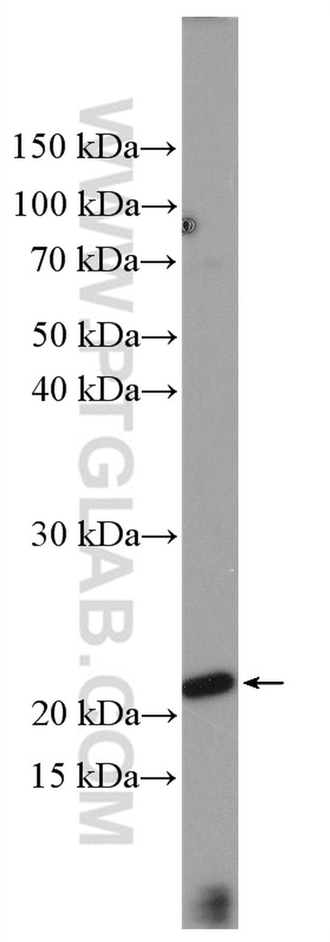 LIF Antibody in Western Blot (WB)