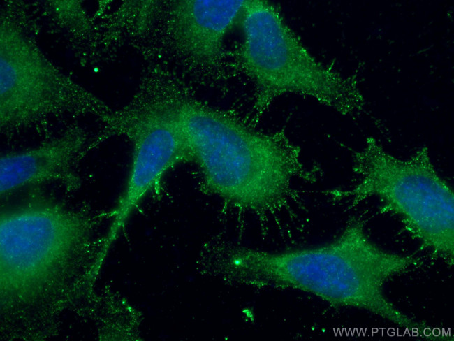 SUFU Antibody in Immunocytochemistry (ICC/IF)