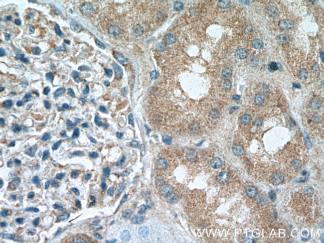 SUFU Antibody in Immunohistochemistry (Paraffin) (IHC (P))