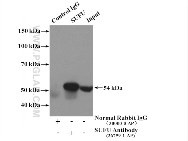 SUFU Antibody in Immunoprecipitation (IP)