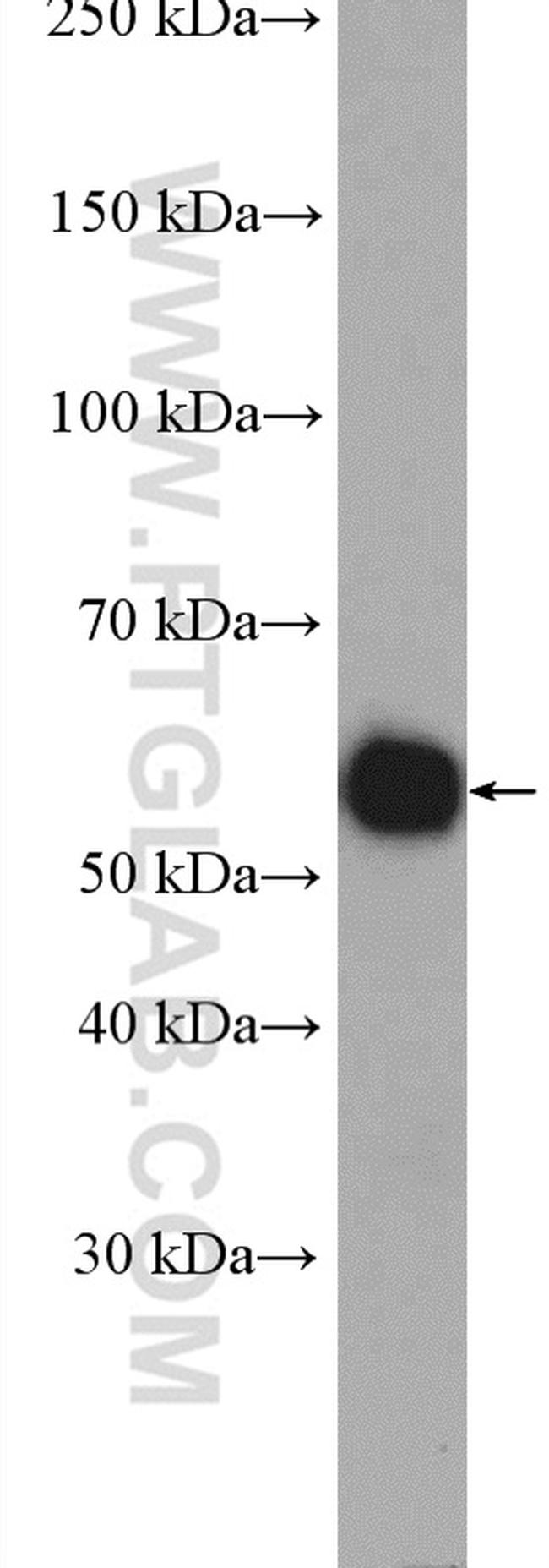 SUFU Antibody in Western Blot (WB)