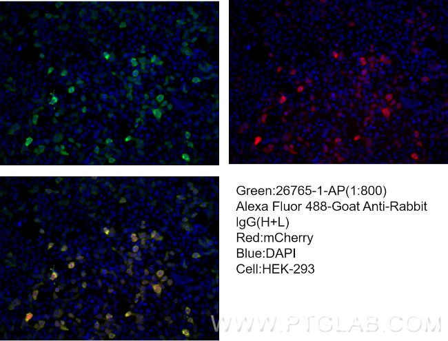 mCherry Antibody in Immunocytochemistry (ICC/IF)