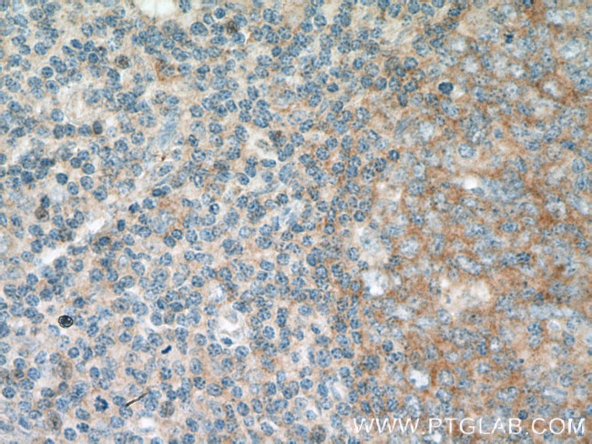 FCHO1 Antibody in Immunohistochemistry (Paraffin) (IHC (P))