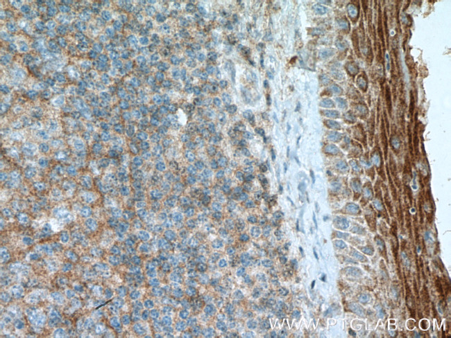 FCHO1 Antibody in Immunohistochemistry (Paraffin) (IHC (P))