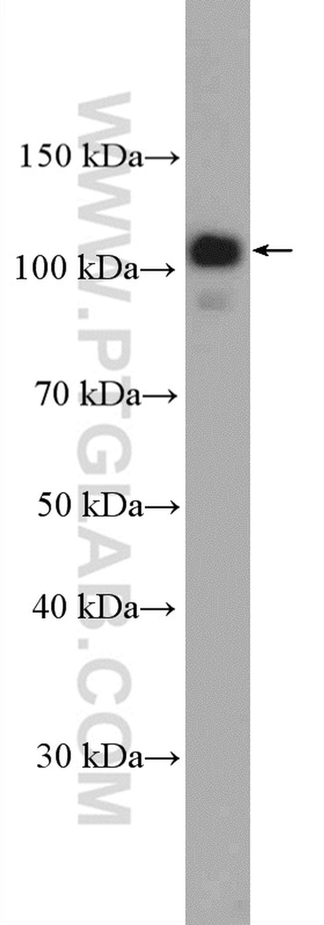 FCHO1 Antibody in Western Blot (WB)