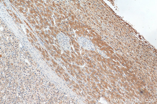 Plasminogen Antibody in Immunohistochemistry (Paraffin) (IHC (P))