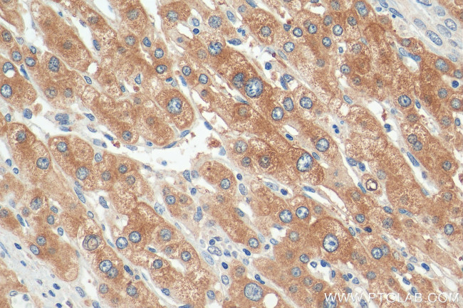 Plasminogen Antibody in Immunohistochemistry (Paraffin) (IHC (P))