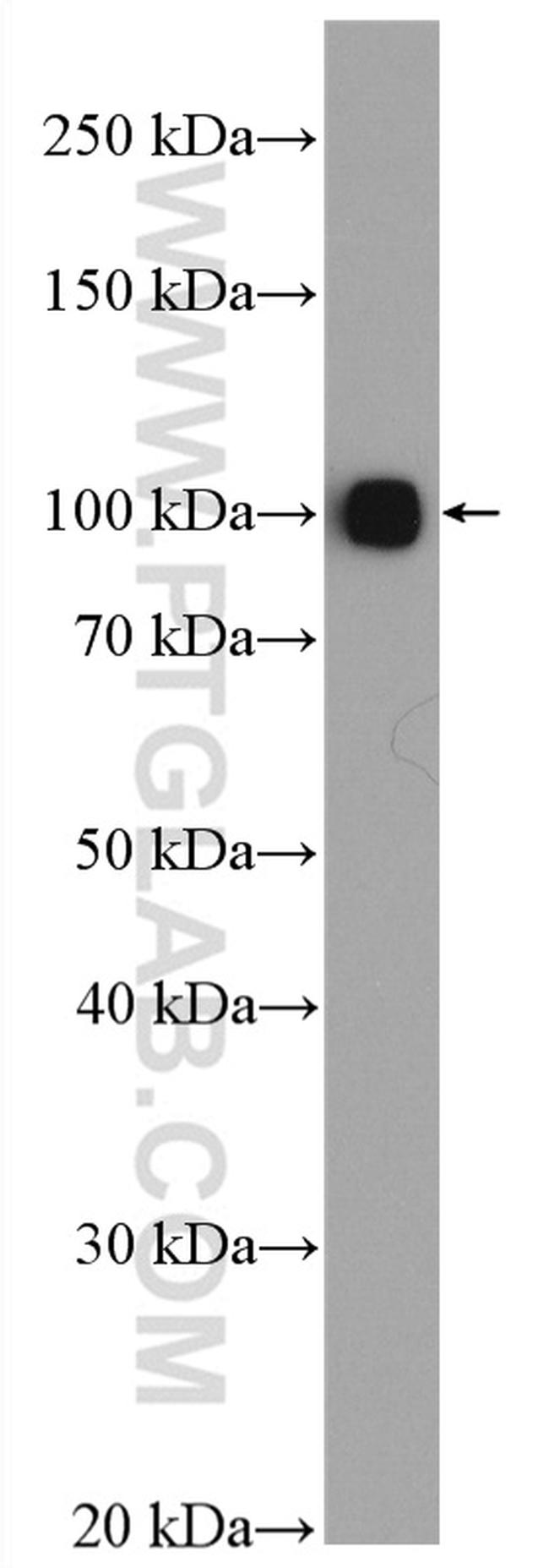 Plasminogen Antibody in Western Blot (WB)