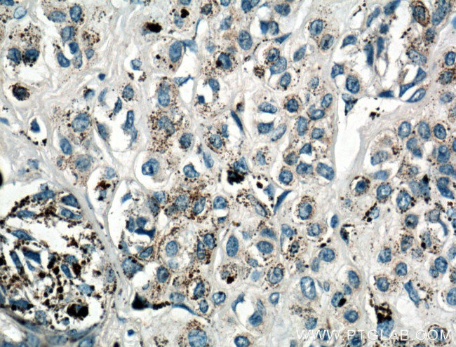 IL-24 Antibody in Immunohistochemistry (Paraffin) (IHC (P))