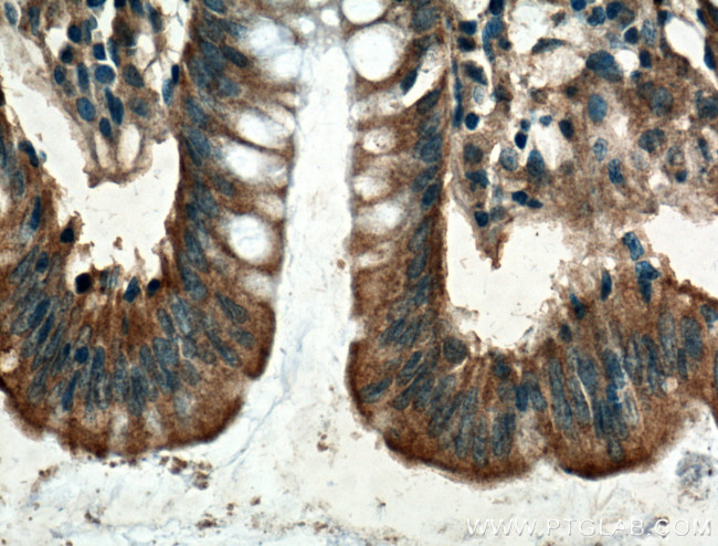 IL-24 Antibody in Immunohistochemistry (Paraffin) (IHC (P))