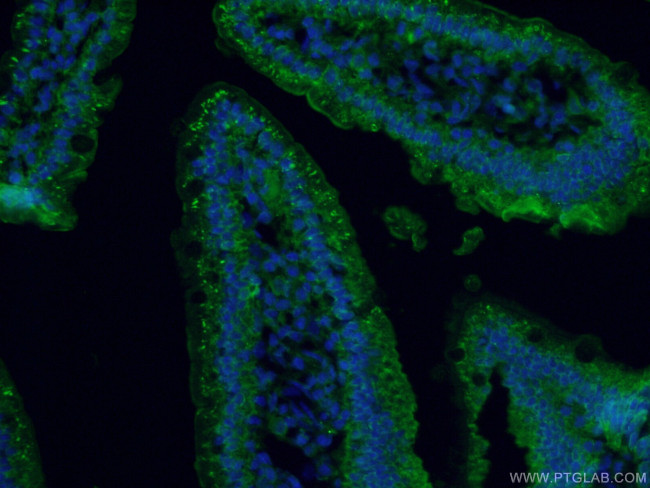 MYO6 Antibody in Immunohistochemistry (Paraffin) (IHC (P))