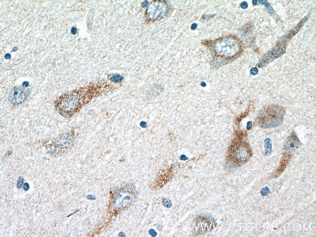 VGF Antibody in Immunohistochemistry (Paraffin) (IHC (P))