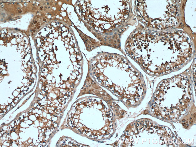 TMBIM6 Antibody in Immunohistochemistry (Paraffin) (IHC (P))