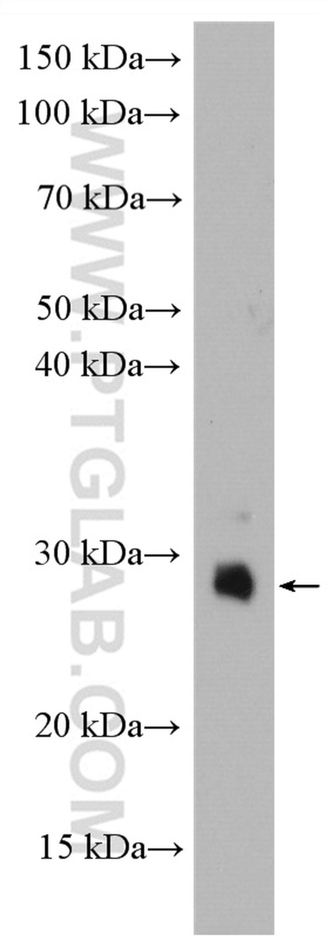 TMBIM6 Antibody in Western Blot (WB)
