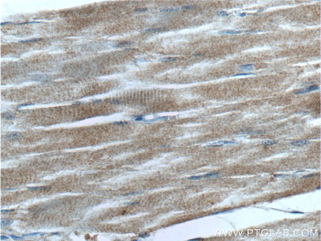 GCGR Antibody in Immunohistochemistry (Paraffin) (IHC (P))