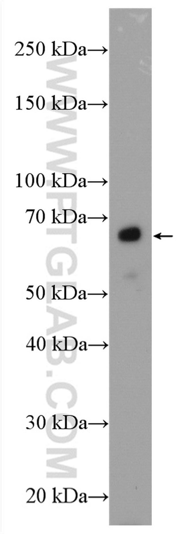 GCGR Antibody in Western Blot (WB)