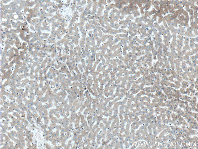 GCGR Antibody in Immunohistochemistry (Paraffin) (IHC (P))