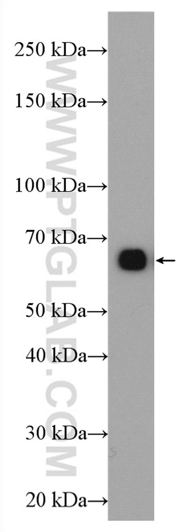 GCGR Antibody in Western Blot (WB)