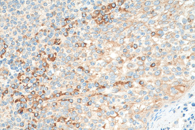 RASGRF2 Antibody in Immunohistochemistry (Paraffin) (IHC (P))