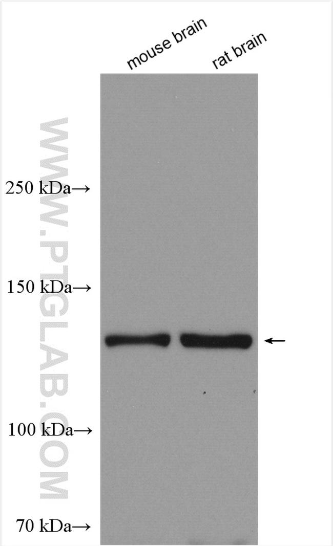 RASGRF2 Antibody in Western Blot (WB)