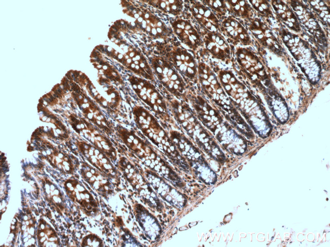 GRLF1 Antibody in Immunohistochemistry (Paraffin) (IHC (P))