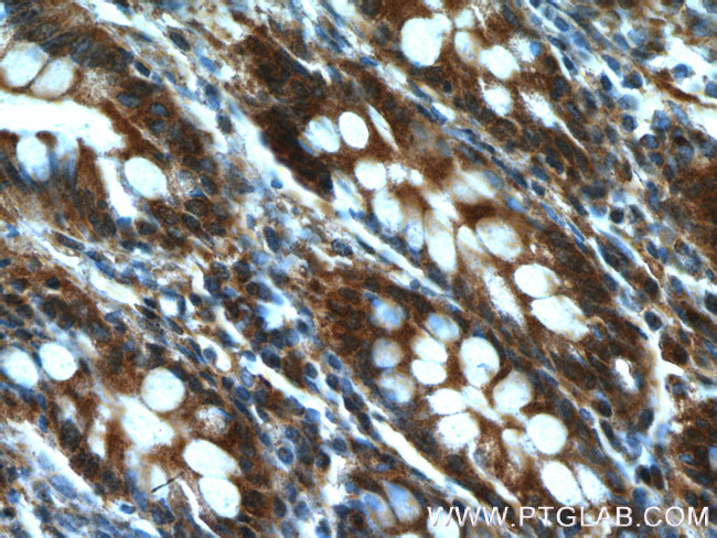 GRLF1 Antibody in Immunohistochemistry (Paraffin) (IHC (P))