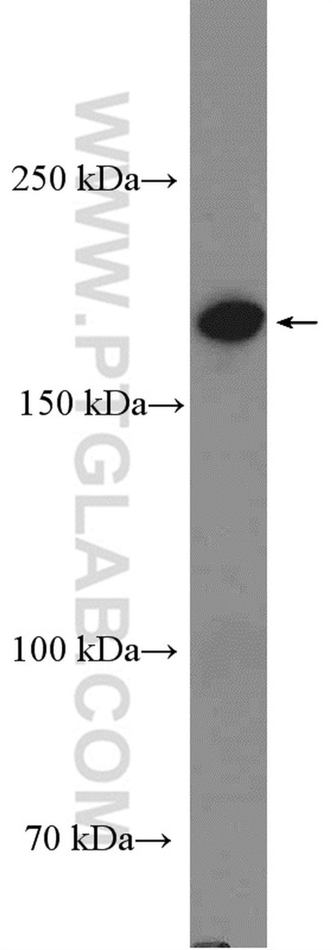 GRLF1 Antibody in Western Blot (WB)