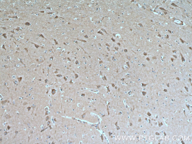 GRLF1 Antibody in Immunohistochemistry (Paraffin) (IHC (P))