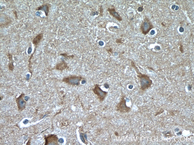 GRLF1 Antibody in Immunohistochemistry (Paraffin) (IHC (P))