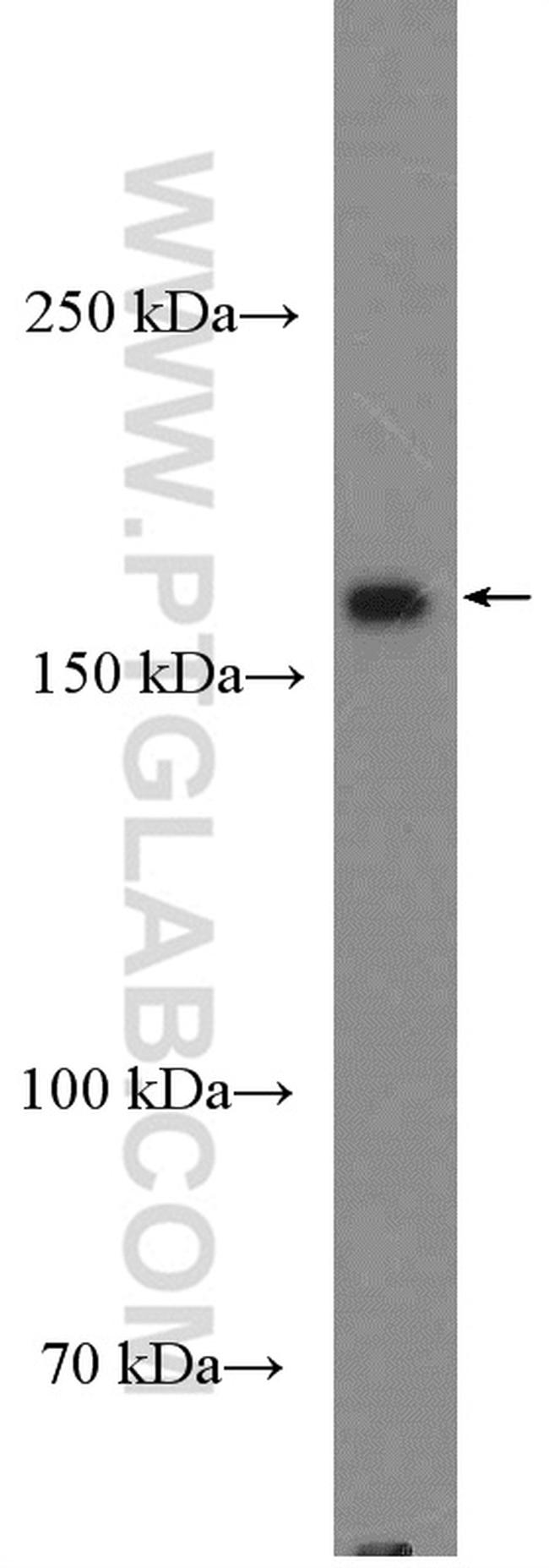 GRLF1 Antibody in Western Blot (WB)