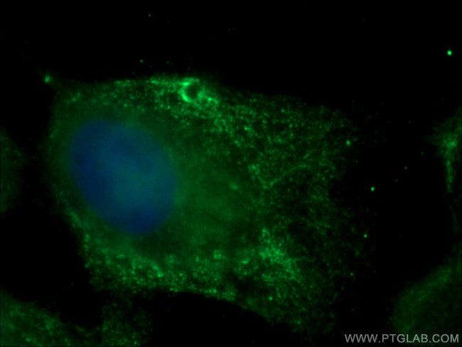 SIPA1 Antibody in Immunocytochemistry (ICC/IF)