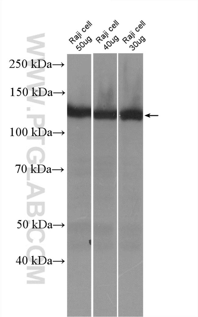 SIPA1 Antibody in Western Blot (WB)